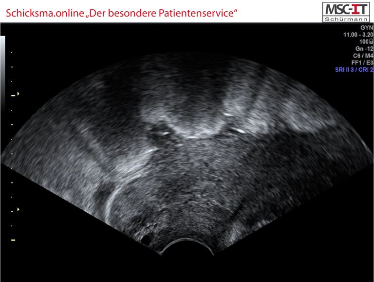 anonymisiertes Ultraschallbild